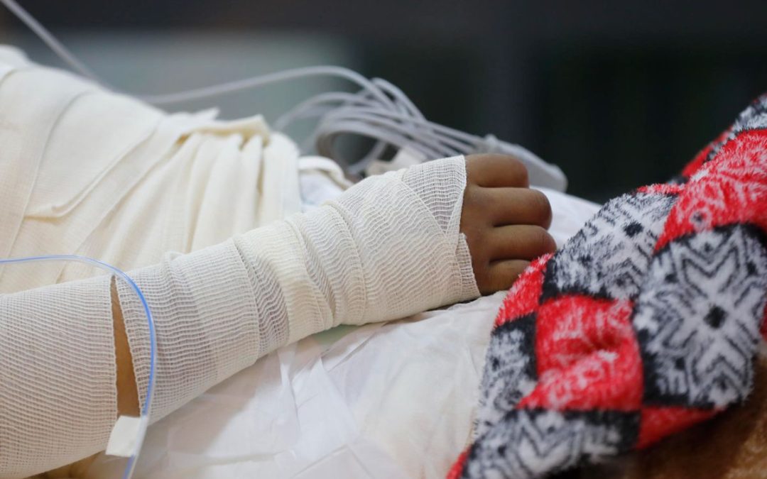 Quemaduras en adolescentes por pugnas del crimen ponen en alerta a expertos