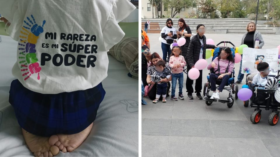 Hasta 25 mil pesos al mes en terapias: el alto costo de las enfermedades raras